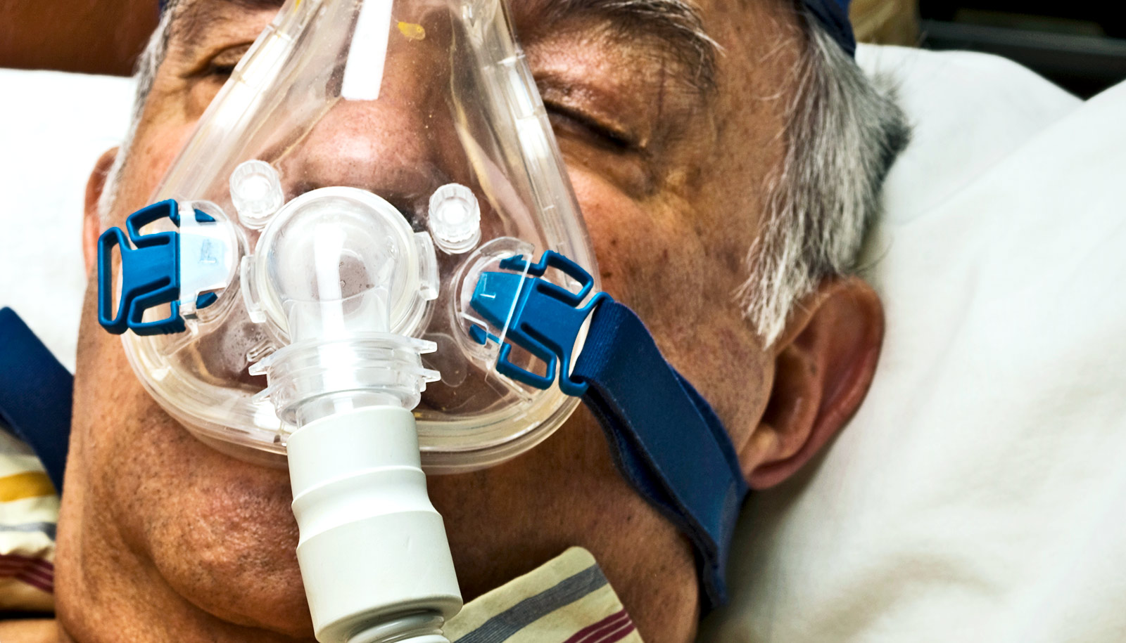 CPAP 如何改善睡眠呼吸暫停患者的生活質量